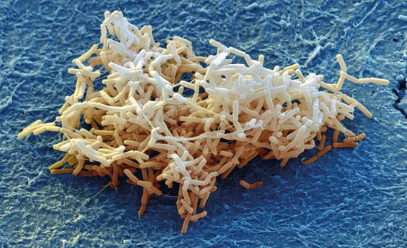 Come controllare i parassiti e le malattie? Biologico vs. chimico